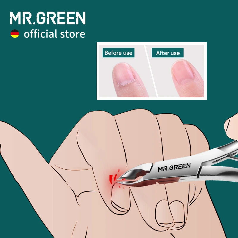 MR.GREEN Cuticle Nippers Nail Clippers Stainless Steel Trimmer