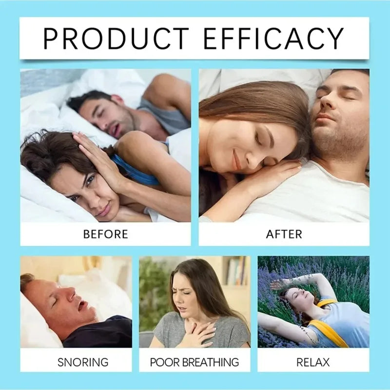 Magnetic Nasal Strips For Sleep And Snoring Reduction